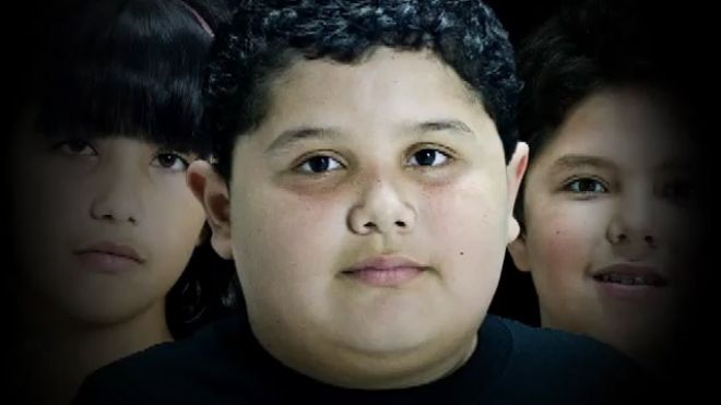 obese latino child